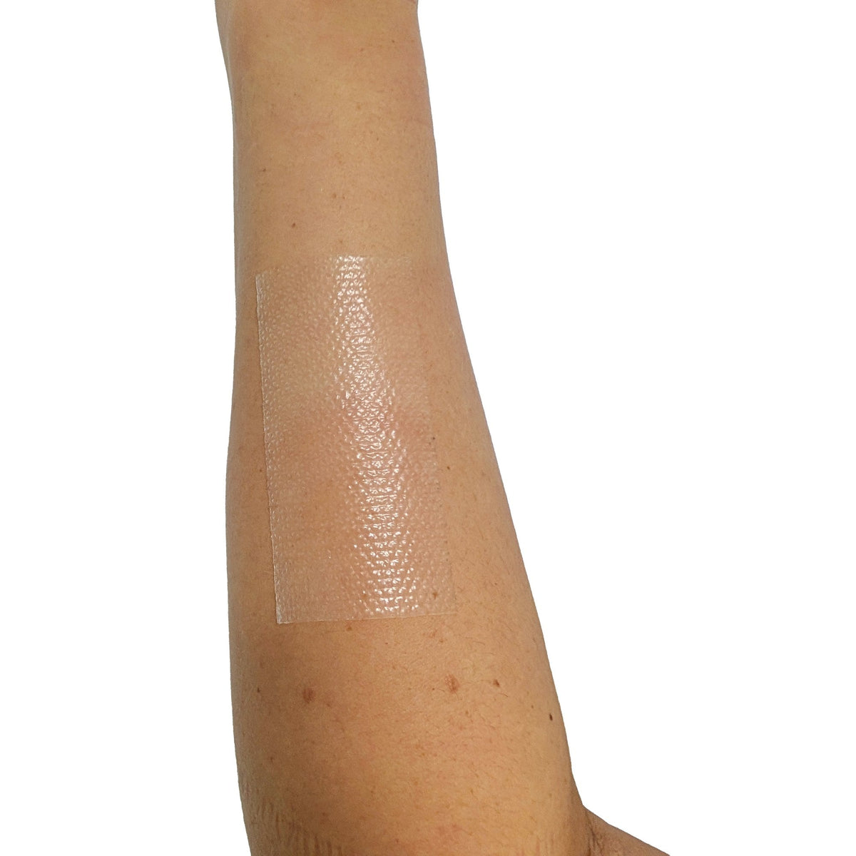 Cerederm silicone strip applied on a forearm scar