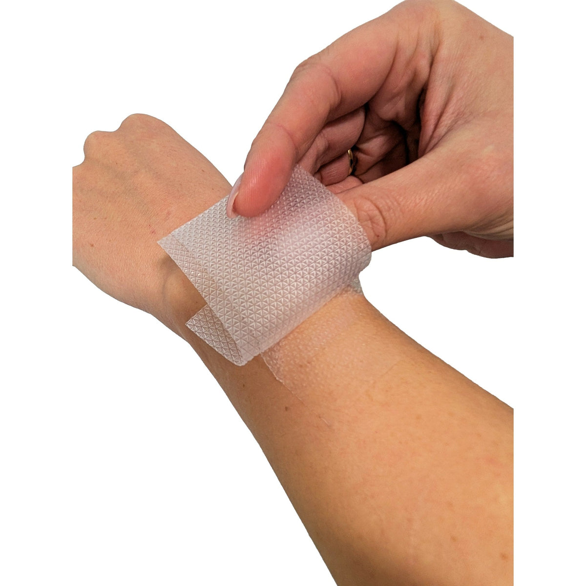 Applying a Cerederm silicone dressing on the wrist